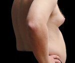 Британские мужчины все чаще уменьшают себе грудь