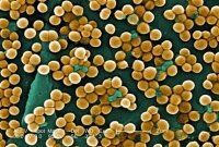 Пещерные бактерии проявили устойчивость к действию антибиотиков
