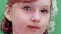 В США трехлетнюю девочку выгнали из ресторана KFC из-за шрамов на лице 